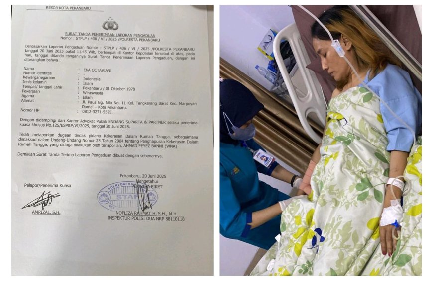 Tak Tahan di Aniaya Suami Bule, Seorang IRT Lapor Ke Polresta Pekanbaru, Korban Berharap Pengaduannya Segera Ditindaklanjuti 