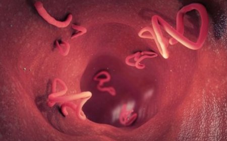 Balita Asal Sukabumi Meninggal Dunia Akibat Infeksi Cacing