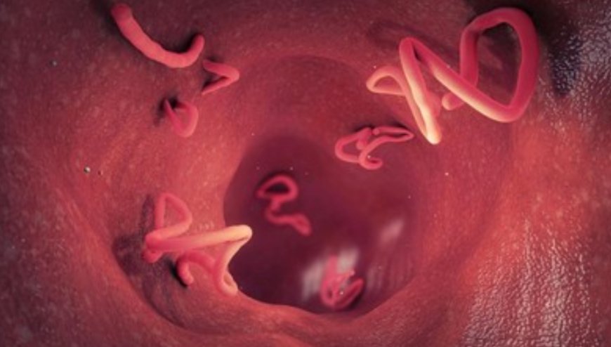 Balita Asal Sukabumi Meninggal Dunia Akibat Infeksi Cacing